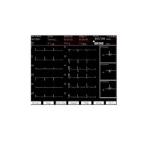 SW k EKG SE 1515